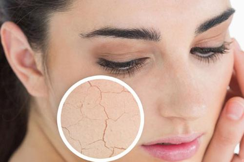 Mùa hanh khô, da dễ bị nẻ, mất nước, lộ rõ nếp nhăn.