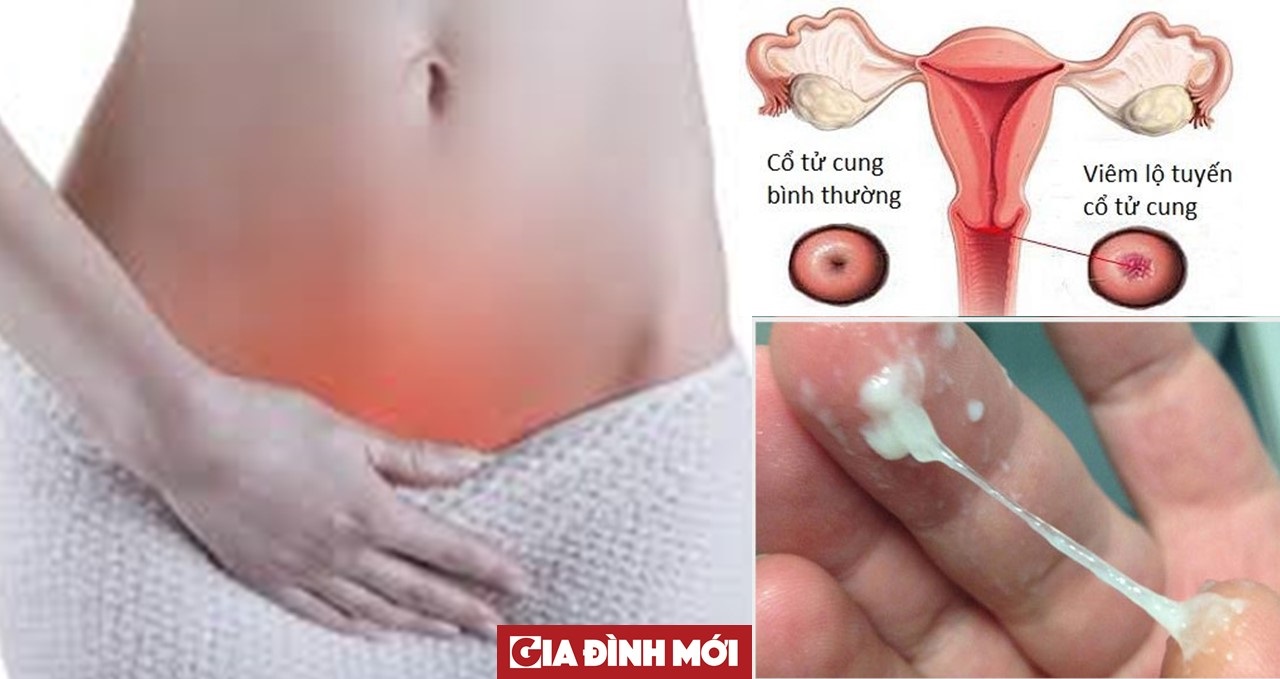 Các bệnh phụ khoa không được điều trị kịp thời, đúng cách rất dễ dẫn đến vô sinh ở phụ nữ. Ảnh minh họa