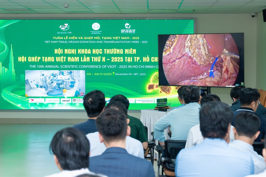 Vinmec trình diễn kỹ thuật ghép gan sống phức tạp tại Hội nghị Ghép tạng Việt Nam 2025- Ảnh 2. Vinmec trình diễn kỹ thuật ghép gan sống phức tạp tại Hội nghị Ghép tạng Việt Nam 2025- Ảnh 2.