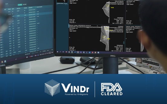 Sản phẩm AI của VinBigdata đạt chứng nhận của FDA, chính thức tiến vào thị trường Mỹ